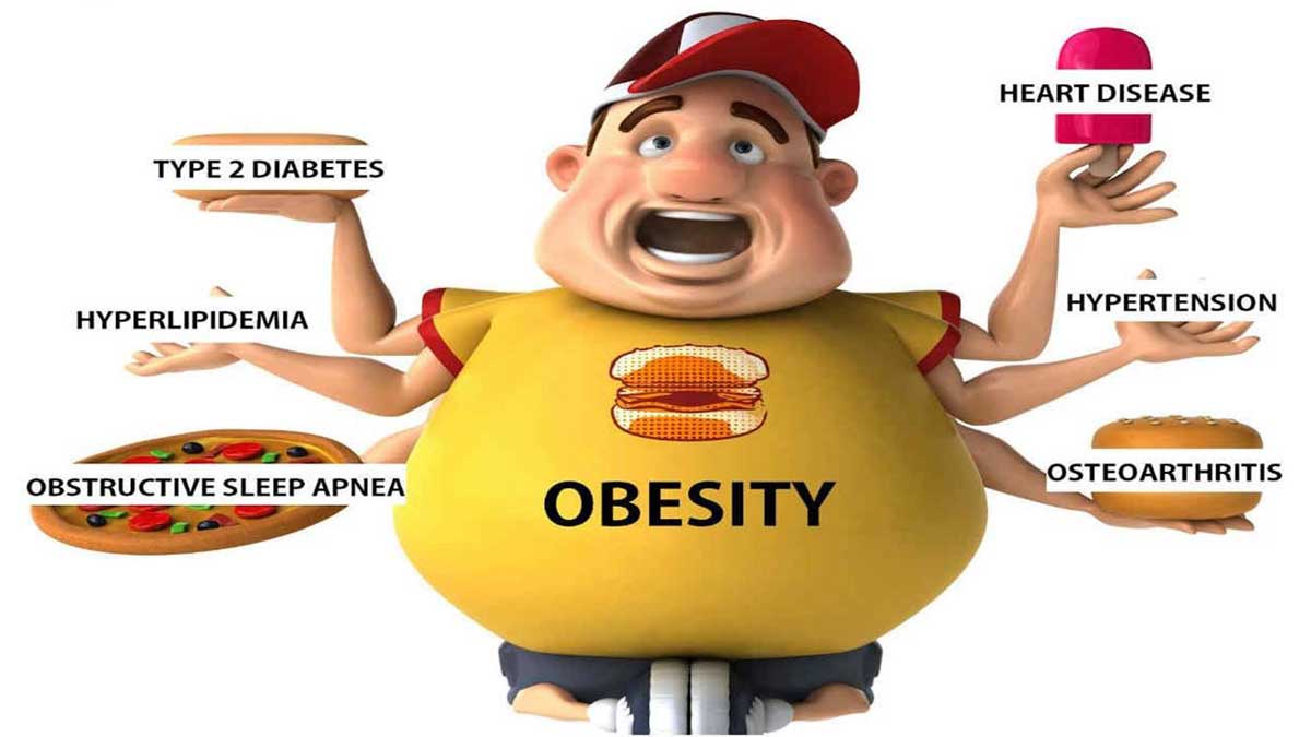 Obesity