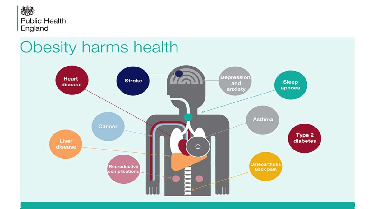 ObesityHarmsHealth